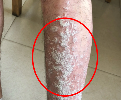 ֣��Ƥ�����Ƶ�ҽԺ