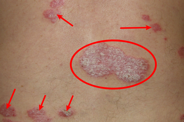 ֣��Ƥ��ר��ҽԺ