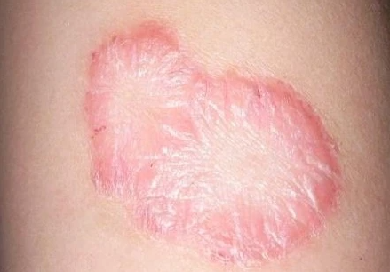 郑州肤康皮肤科