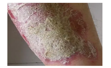 郑州肤康皮肤科