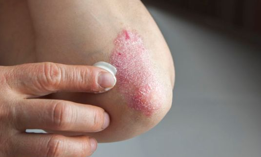 郑州肤康皮肤科