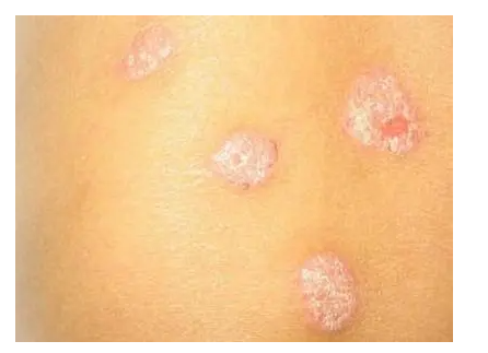 郑州肤康皮肤科