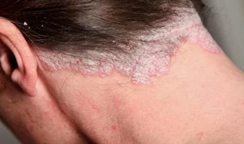 郑州肤康皮肤科