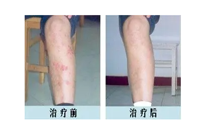 郑州肤康皮肤科