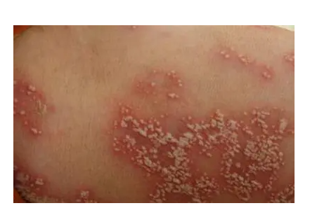 郑州肤康皮肤科