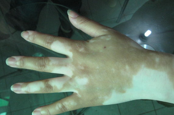 郑州肤康皮肤科