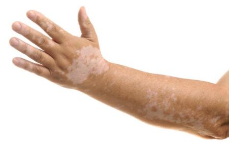 ֣�ݷ���Ƥ����