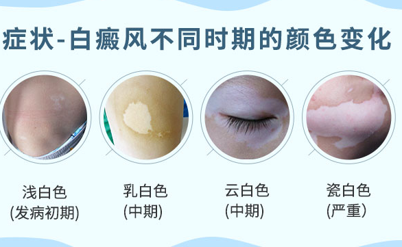 郑州肤康皮肤科