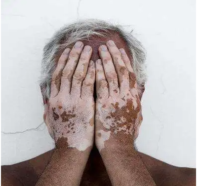 郑州肤康皮肤科