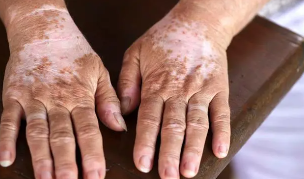 郑州肤康皮肤科