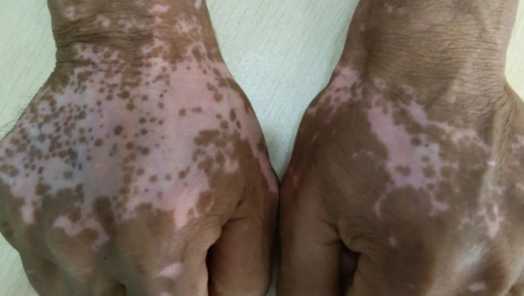 郑州肤康皮肤科