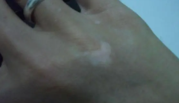 郑州肤康皮肤科