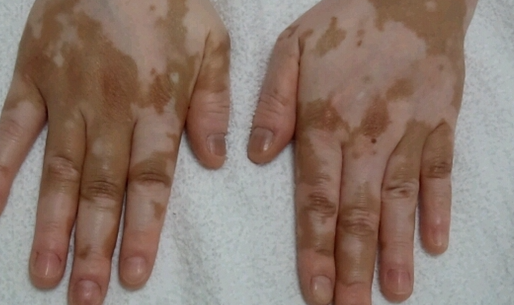 郑州肤康皮肤科